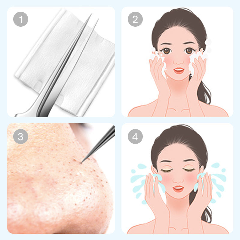 💓HOT SALE 50% OFF💥Stainless Steel Blackhead Removal Kit (with free alcohol pads)