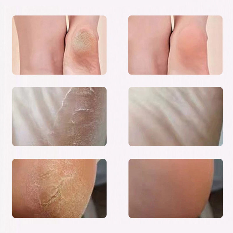 Electric Foot Scrubber for Smooth Healthy Skin